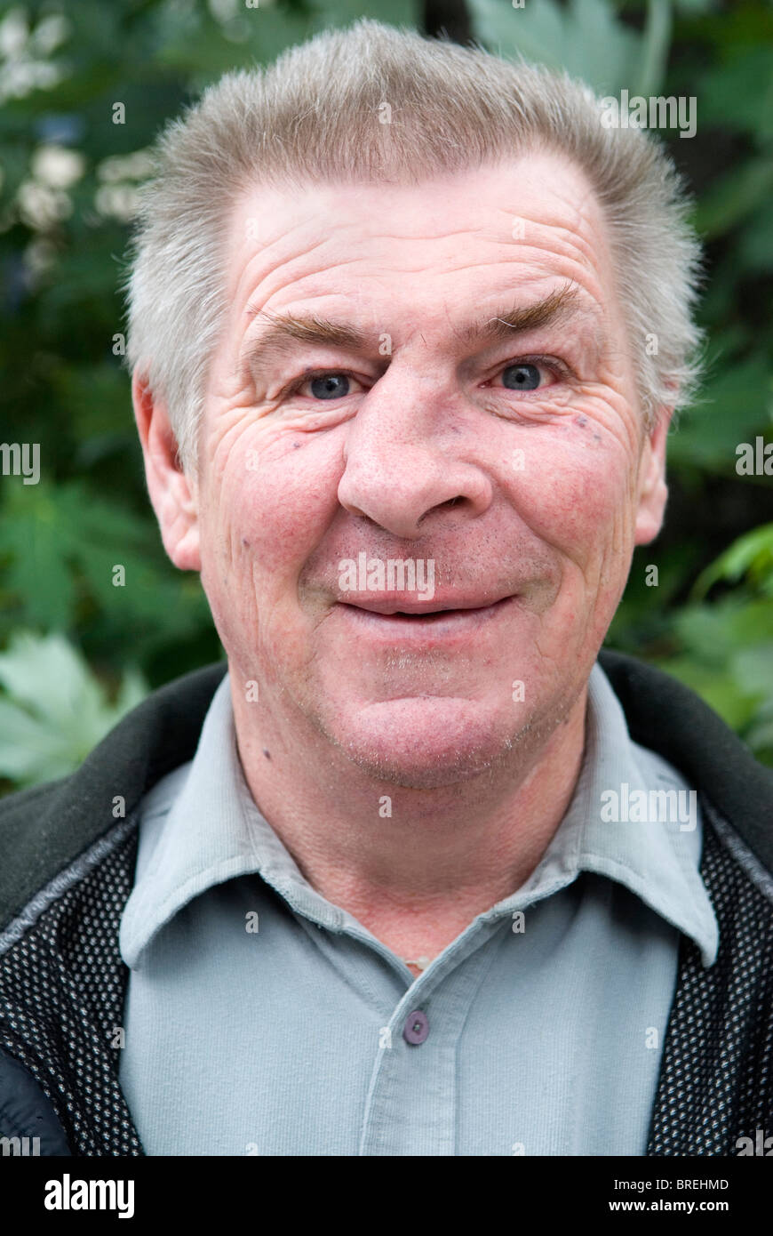 Homme Au Nez Casse Banque D Image Et Photos Alamy