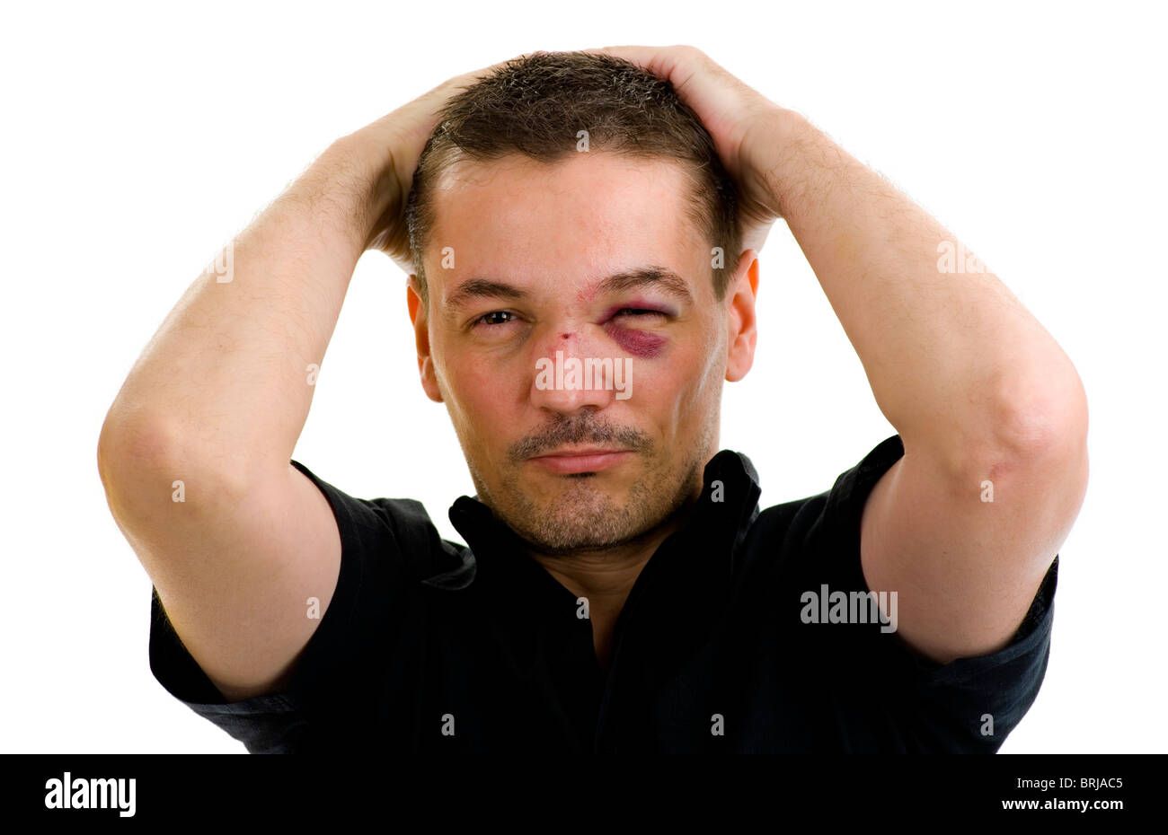 Man with broken, nez de travers et le noir, les yeux croisés, isolated on white Banque D'Images