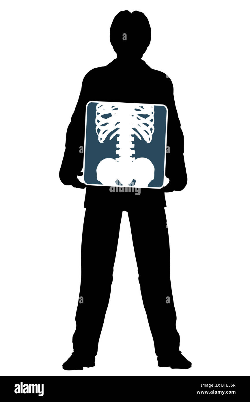 L'Illustre silhouette d'un homme tenant une radiographie de l'abdomen Banque D'Images