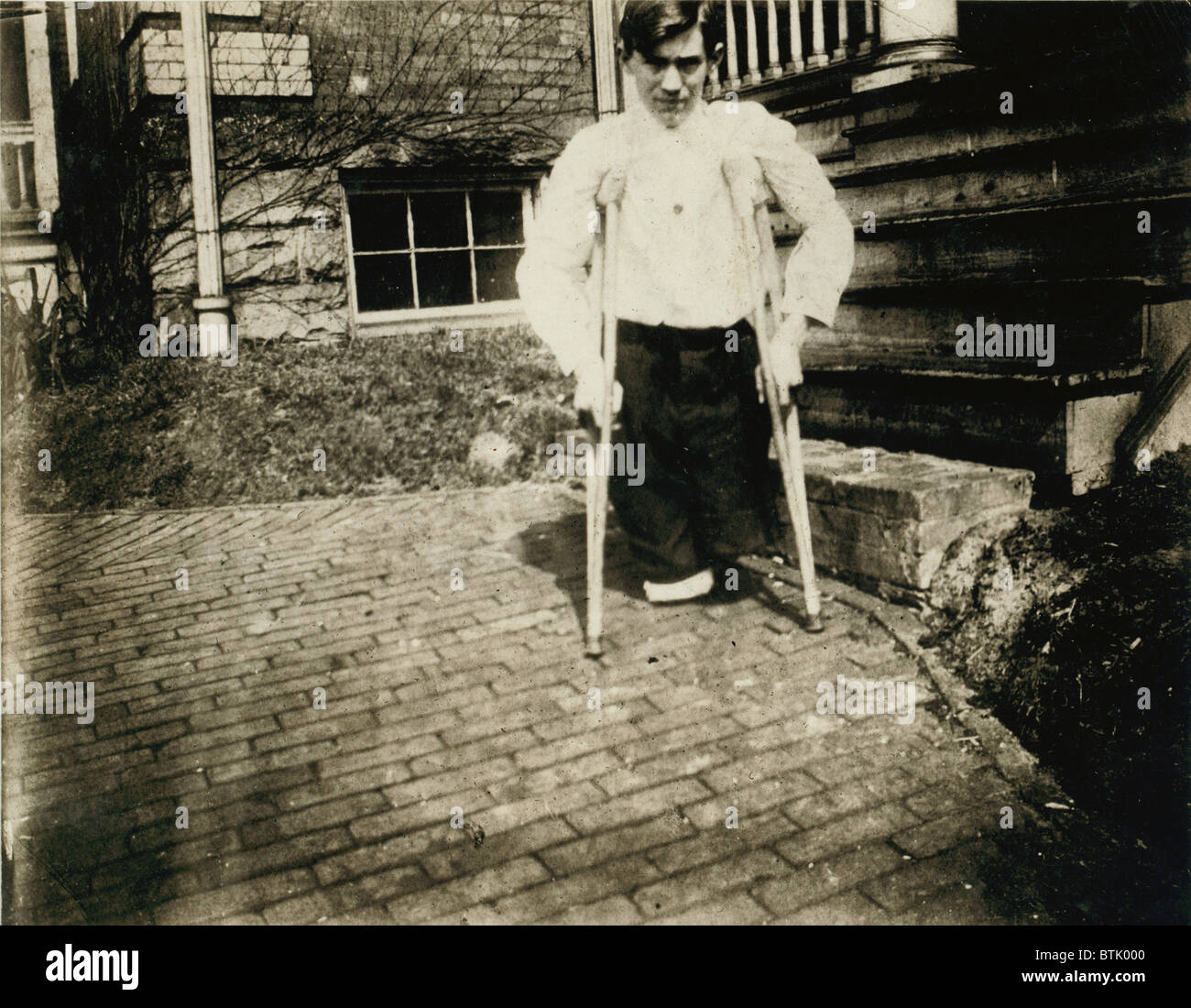Le travail des enfants, Frank, dont les jambes ont été coupées par une voiture dans une mine de charbon en Virginie de l'Ouest lorsqu'il avait 14 ans, l'âge de 10 mois, en Virginie de l'Ouest, photo de Lewis Wickes Hine, Mars, 1910. Banque D'Images