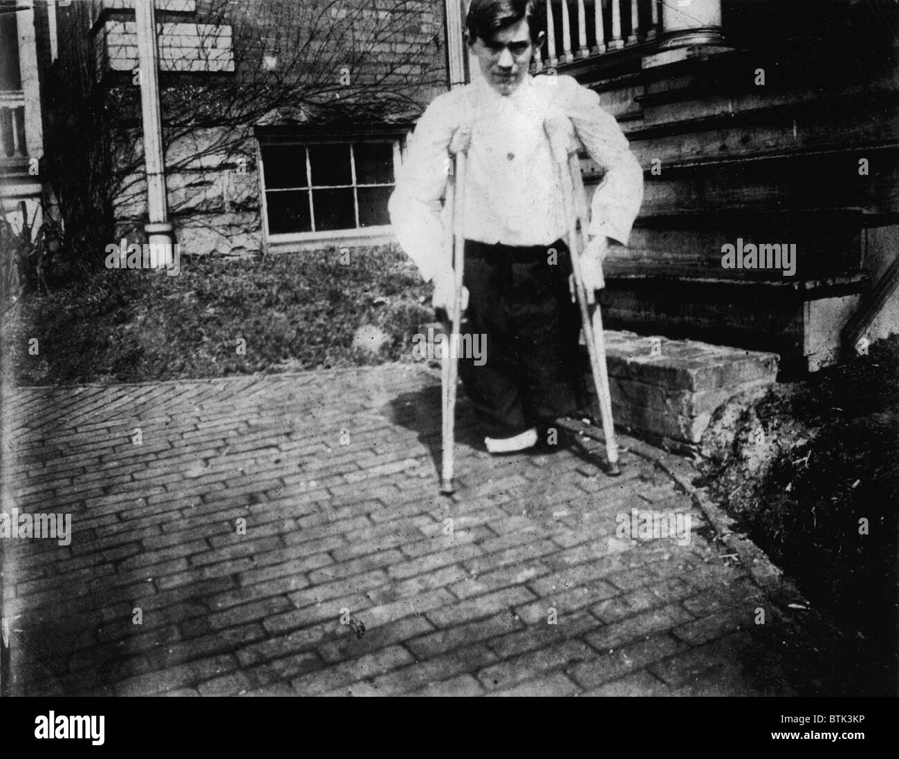 Le travail des enfants, Frank P., les jambes ont été coupées par une automobile dans une mine de charbon lorsqu'il était âgé de 14 ans, Monongah, West Virginia, photo de Lewis Wickes Hine, Mars, 1910 Banque D'Images