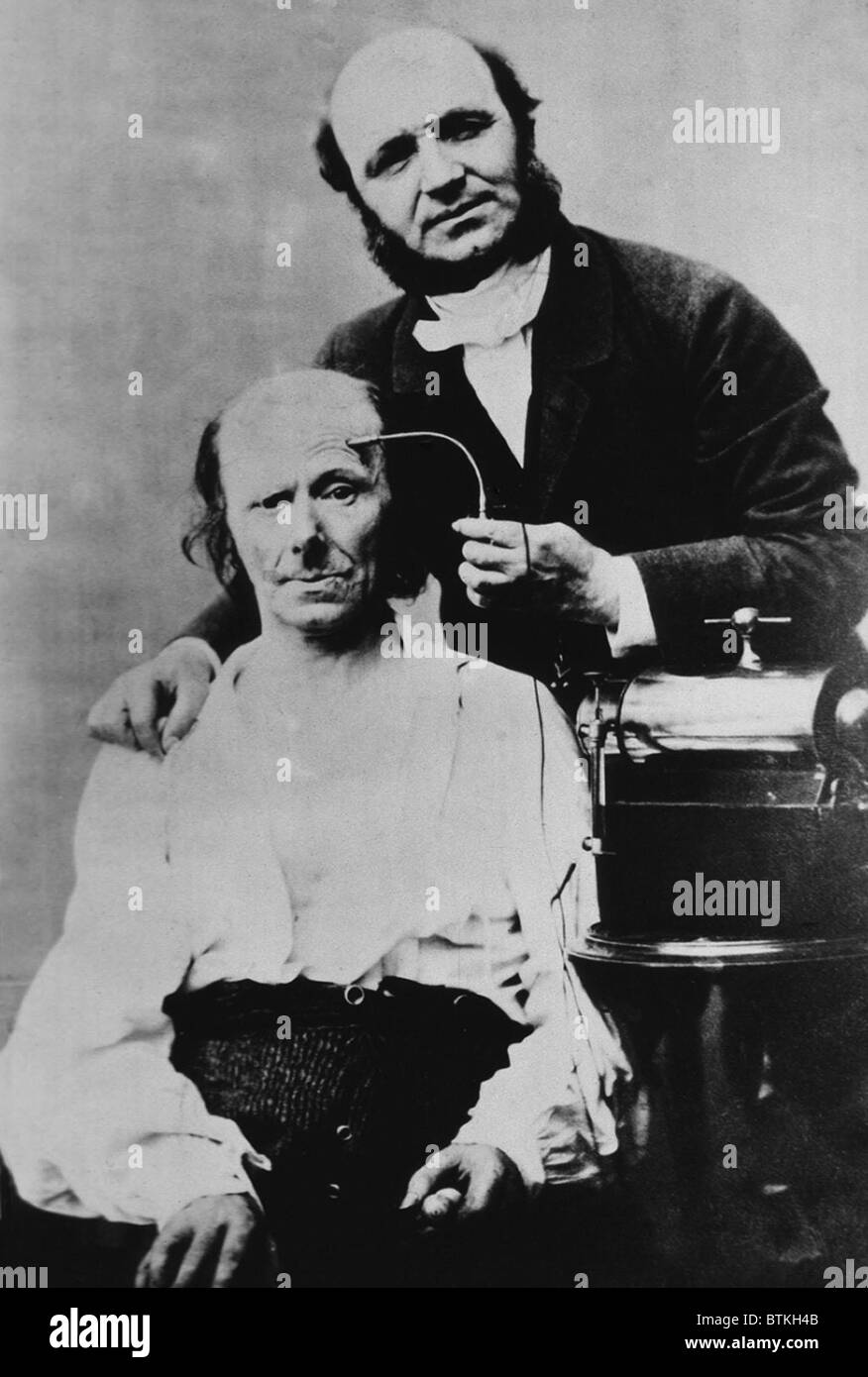 Guillaume Duchenne (1806-1875), médecin français, effectué des expériences de l'effet de l'électricité sur les muscles. En maintenant une électrode à la tête du patient, il a causé des contractions musculaires qui ont abouti dans les expressions qu'il a photographié à l'hôpital Salpetriere à Paris. 1861. Banque D'Images