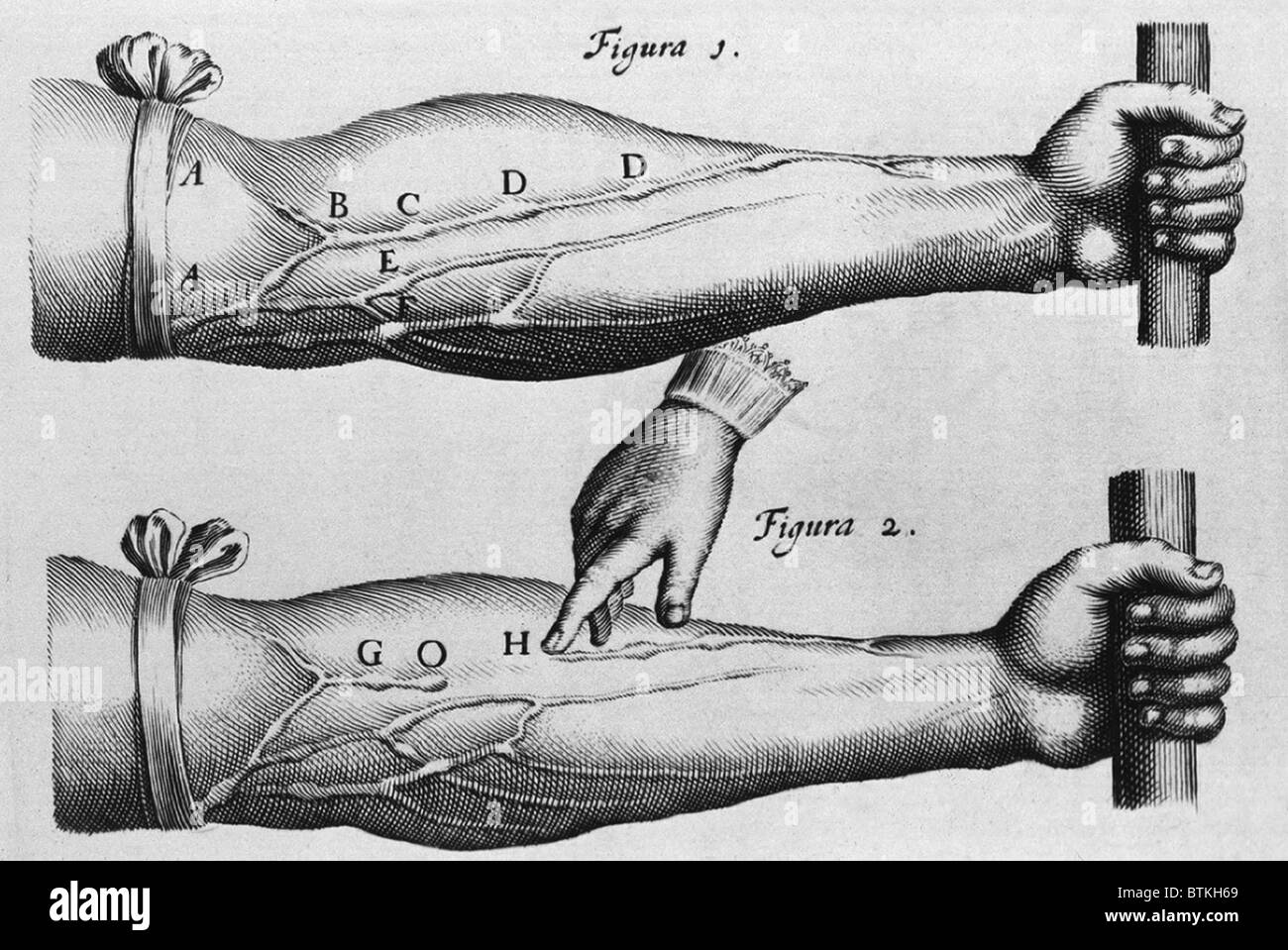 La circulation du sang par William Harvey's SUR LES MOUVEMENTS DU CŒUR ET DU SANG, 1628. Les illustrations d'un tourniqueted l'avant-bras, avec des veines du sang superficiel pour indiquer la circulation. Fig.1 : Vaisseau bosses indiquant la mise en commun dans le sang des valves dans les veines. Fig.2 : la pression du doigt sur un navire indique le débit moyen de sang. Banque D'Images