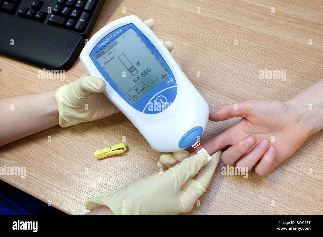 Système de surveillance de la coagulation La coagulation du sang des patients pour les essais, Banque D'Images