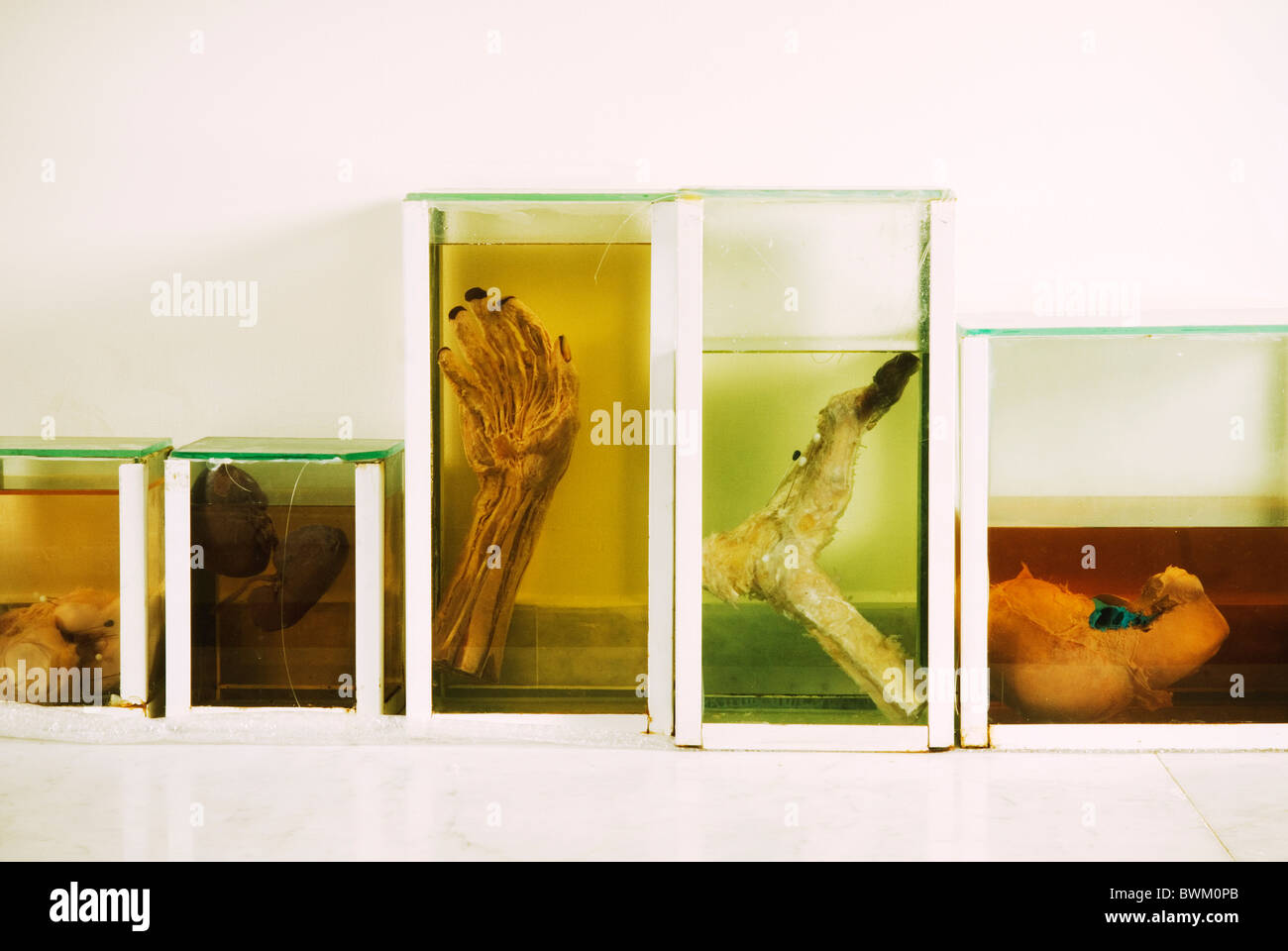 Les organes humains embaumés dans des récipients en verre à l'intérieur de la faculté de médecine de l'Université arabe de Beyrouth Liban Moyen Orient Banque D'Images