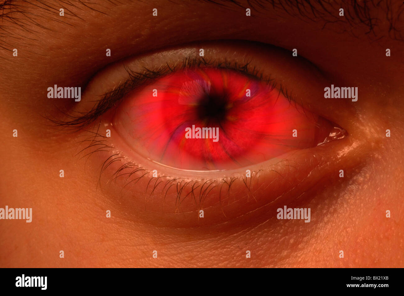 Close-up du globe oculaire avec un oeil mauvais vortex rouge Banque D'Images