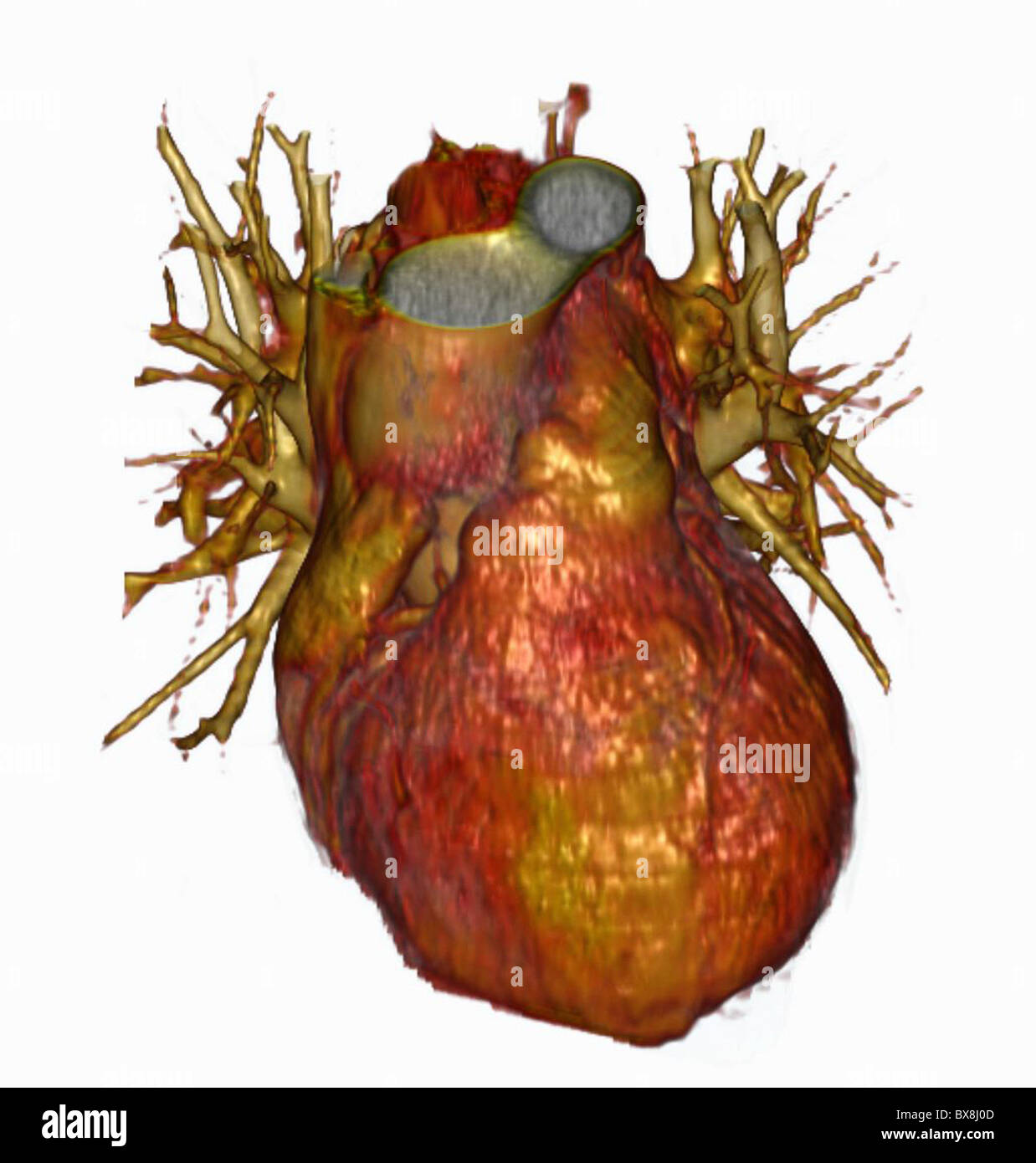 3D CT scan de la tête d'un homme âgé Banque D'Images