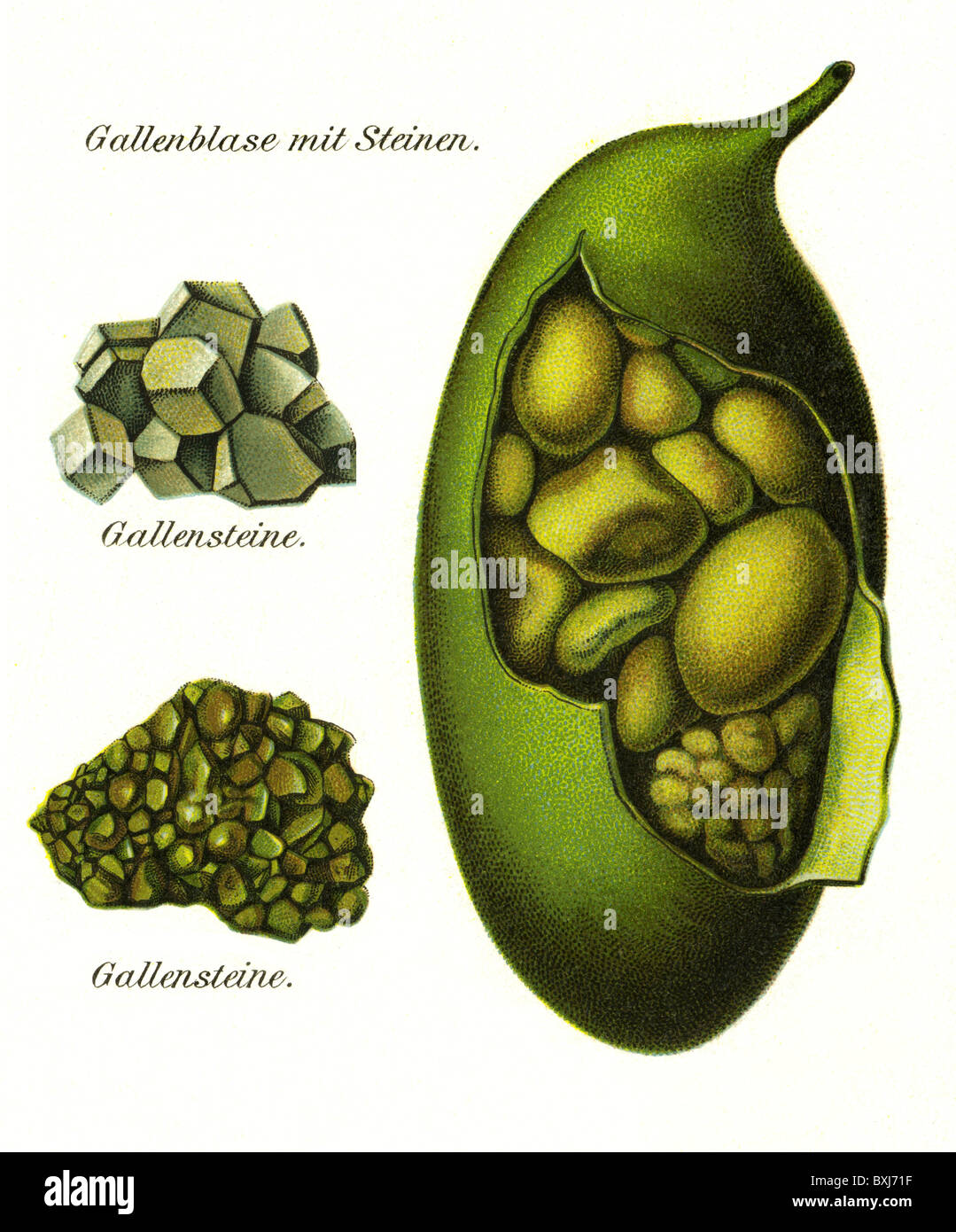Médecine, anatomie, organes, vésicule biliaire, lithographie, Allemagne, vers 1900, droits additionnels-Clearences-non disponible Banque D'Images