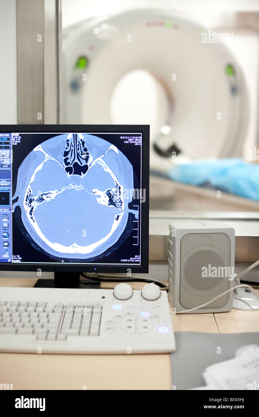 L'imagerie CAT scan Banque D'Images