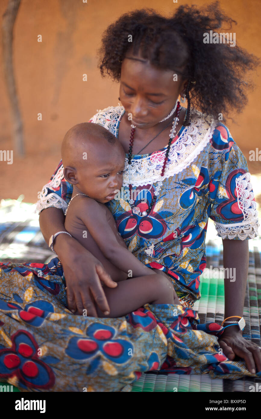 Dans la ville de Djibo, au nord du Burkina Faso, un enfant Peul est malade avec le paludisme, une maladie transmise par les moustiques. Banque D'Images
