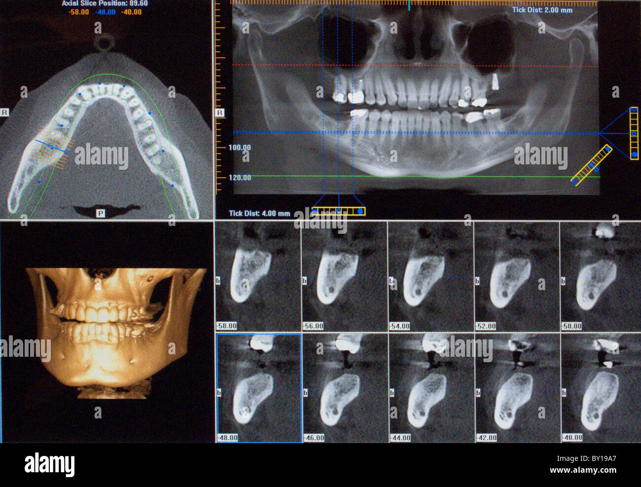 radiographie des dents Banque D'Images