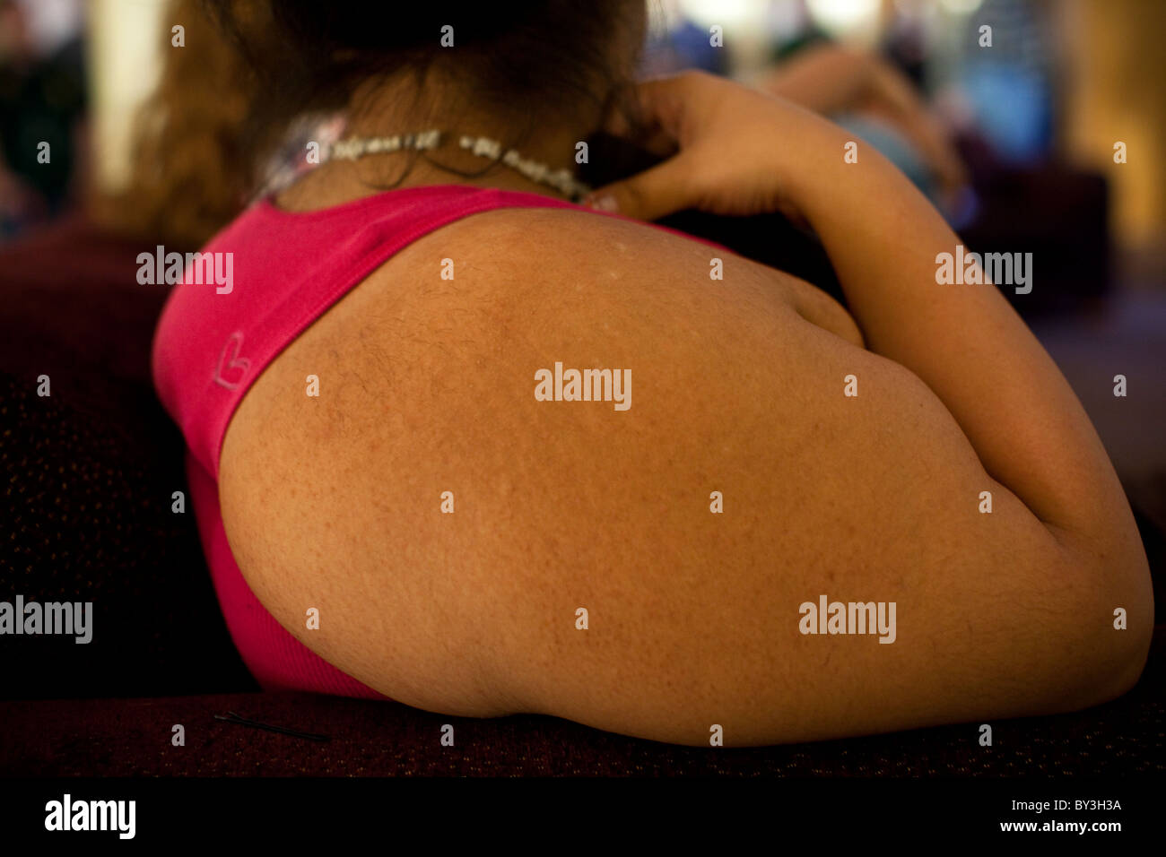 Reedley hallows, California, United States. Un bras d'une adolescente obèse. Banque D'Images