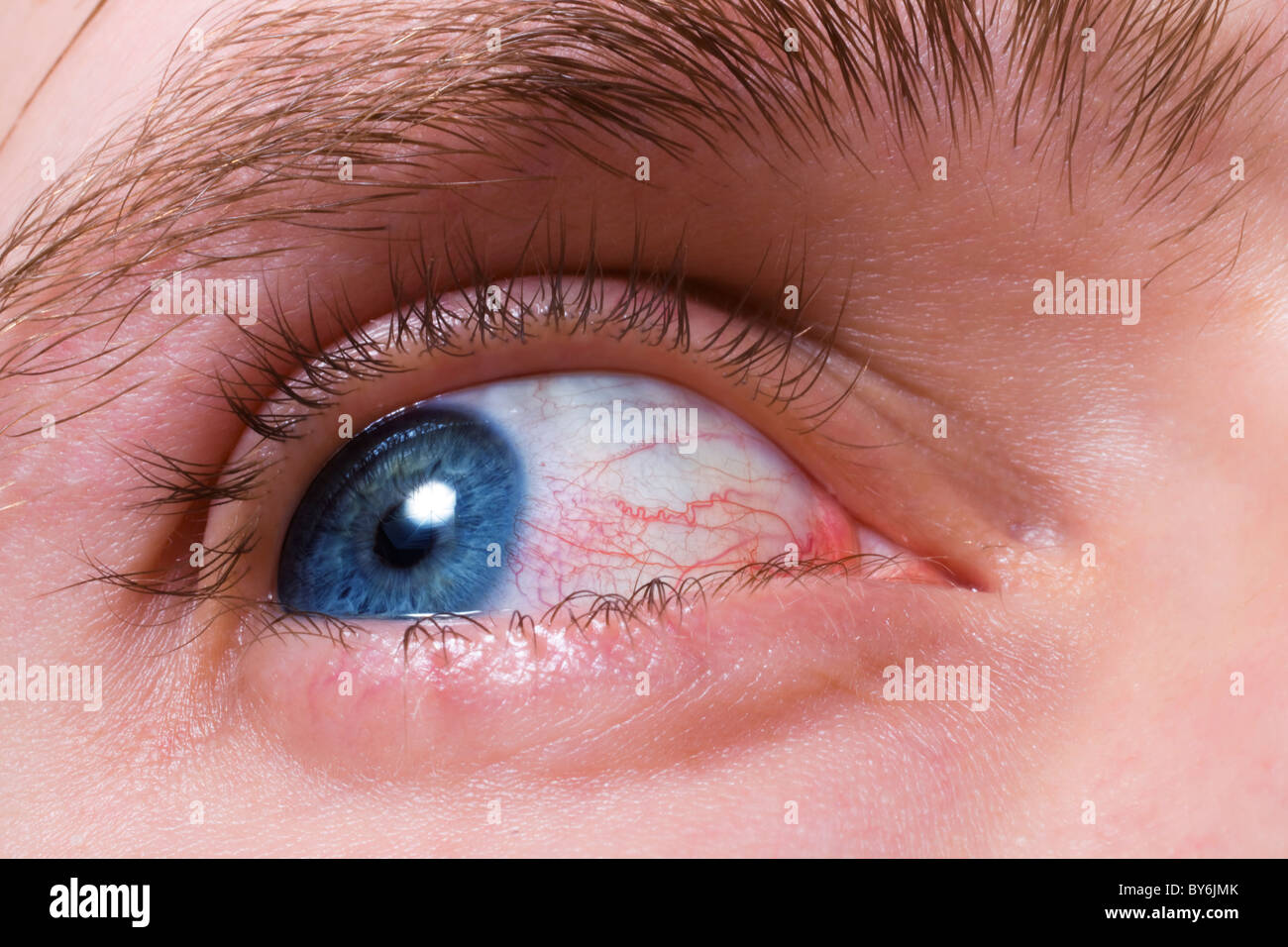 Vaisseaux Sanguins Oculaires Banque D Image Et Photos Alamy