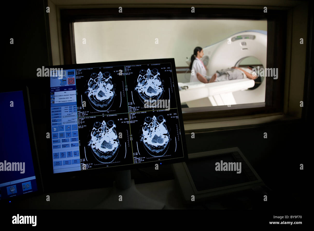 Les résultats de l'examen IRM sur un ordinateur Banque D'Images