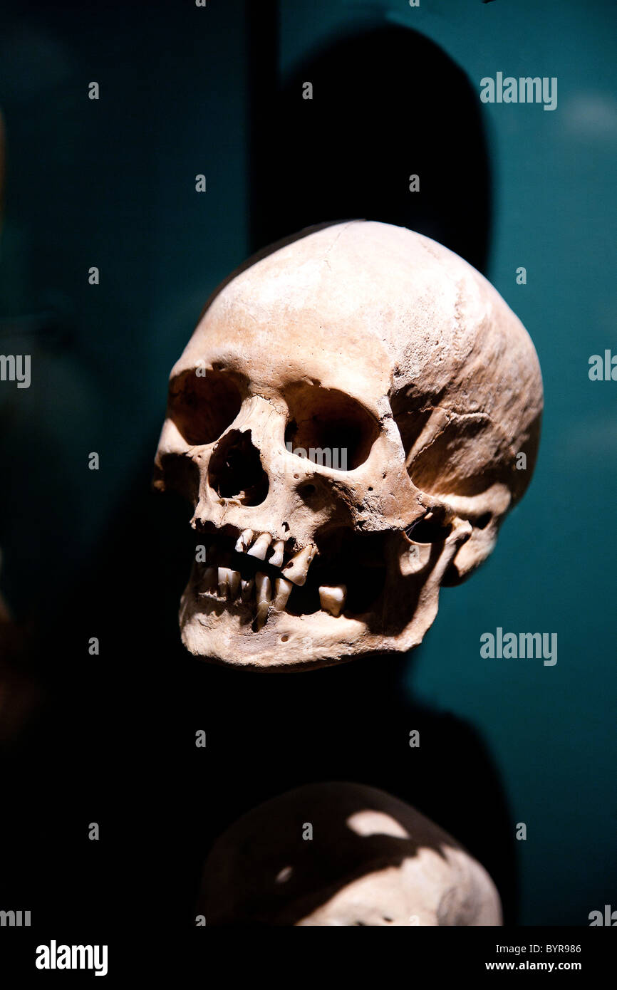 Crâne humain sur l'exposition dans un musée Banque D'Images