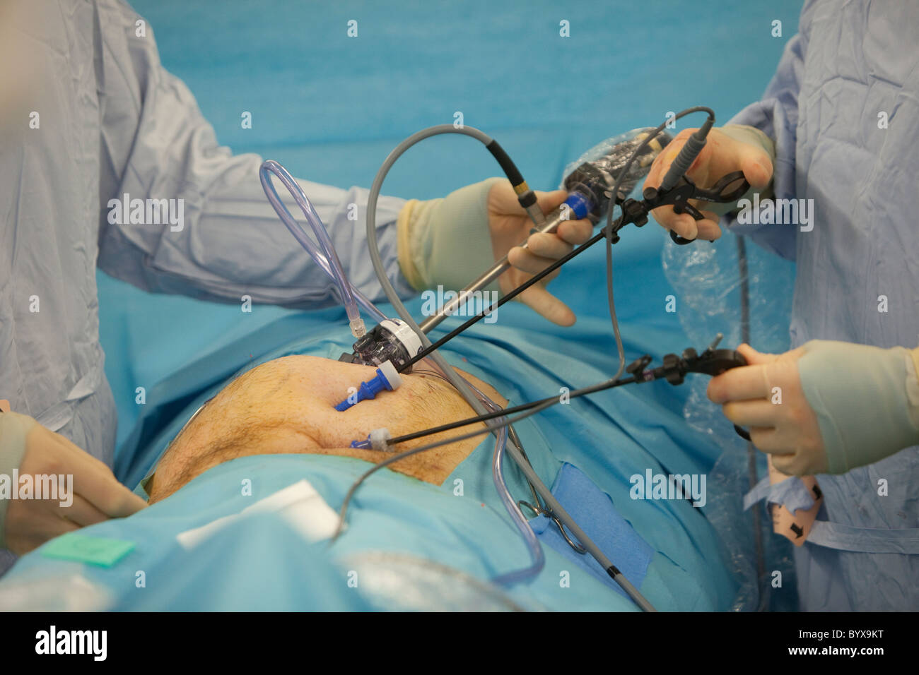 Laparascopic la chirurgie pour réparer une hernie inguinale Banque D'Images