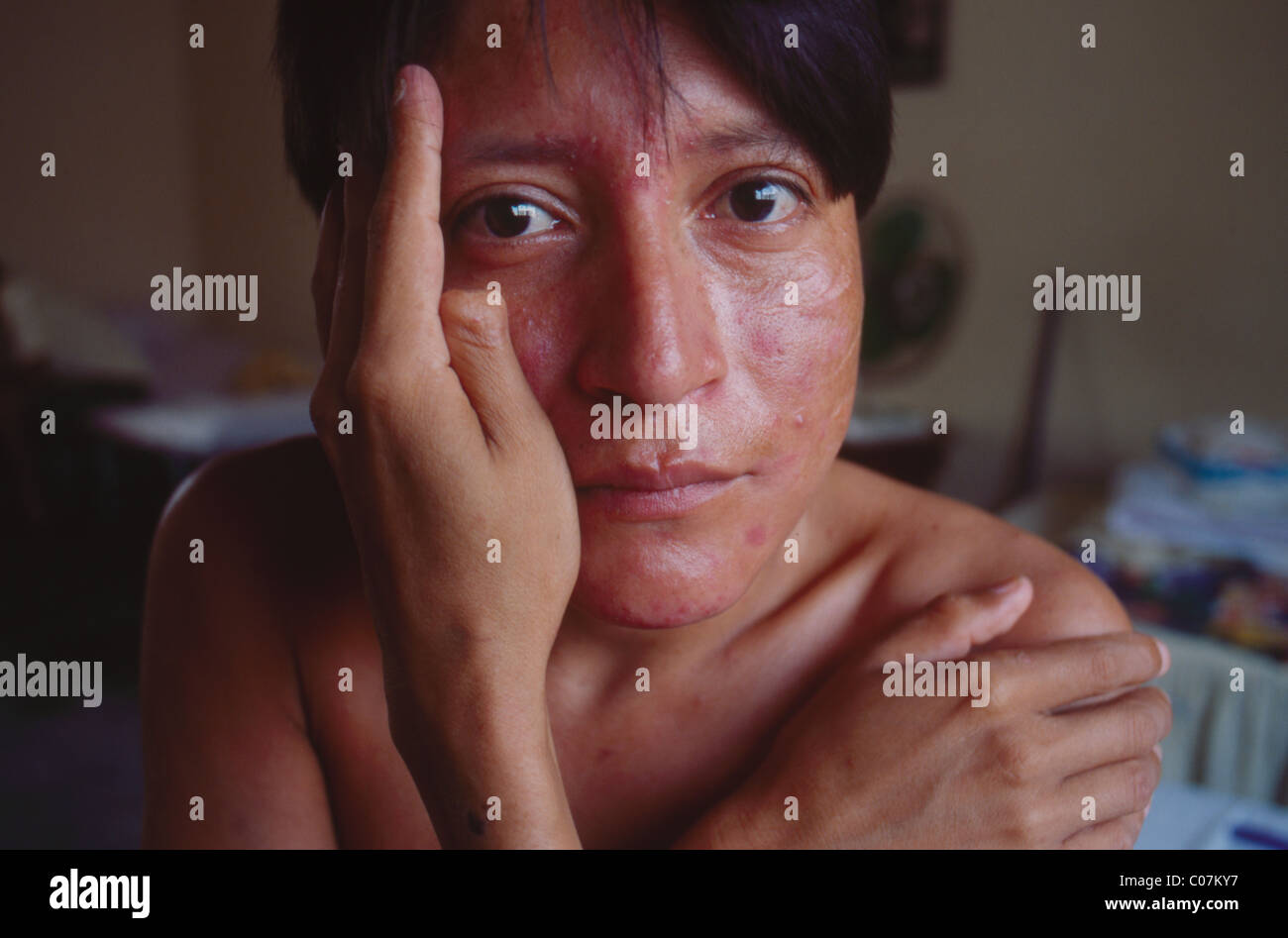 Malade Du Sida A L Hospice De San Jose A San Pedro Sula Honduras Photo Stock Alamy Malade Du Sida A L Hospice De San Jose A San Pedro Sula Honduras Photo Stock Alamy