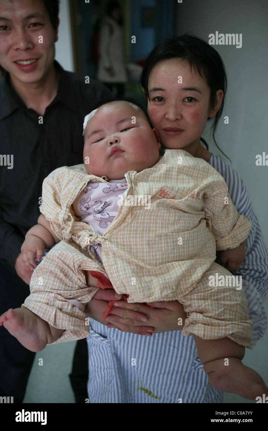 Soucis De Poids Pour Ce Gros Bebe Obese Pese Bebe Un Enorme 19 Kilogrammes 42 Livres Liu Yuqing Est Seulement 2 5 Photo Stock Alamy