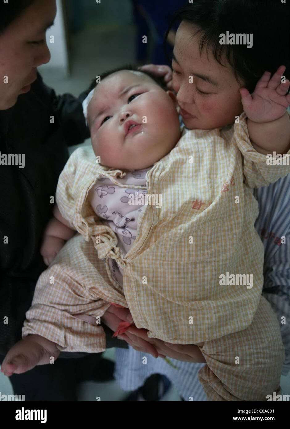 Soucis De Poids Pour Ce Gros Bebe Obese Pese Bebe Un Enorme 19 Kilogrammes 42 Livres Liu Yuqing Est Seulement 2 5 Photo Stock Alamy Soucis De Poids Pour Ce Gros Bebe Obese Pese Bebe Un Enorme 19 Kilogrammes 42 Livres Liu Yuqing Est Seulement 2 5 Photo Stock Alamy