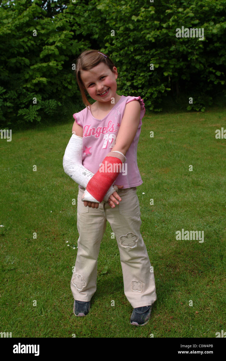 Petite fille avec deux bras cassés Banque D'Images