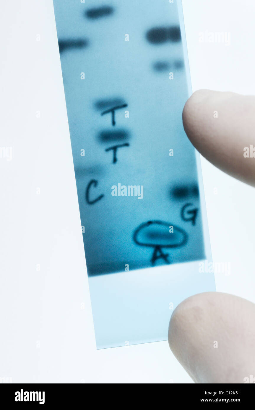 Le séquençage de l'ADN. Points aux bandes représentant scientifique bases nucléotidiques (A,C,T,G) dans une radiographie d'un gel. Méthode de Sanger. Banque D'Images