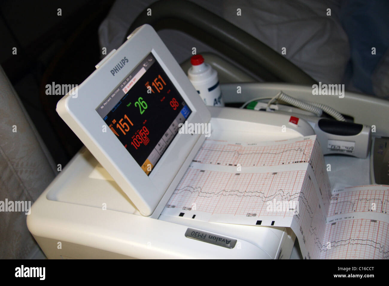 Électrocardiographe ecg moniteur de fréquence cardiaque grossesse maternité  bébé enfant à naître l'impression de lire la vie de signal concept editori  Photo Stock - Alamy