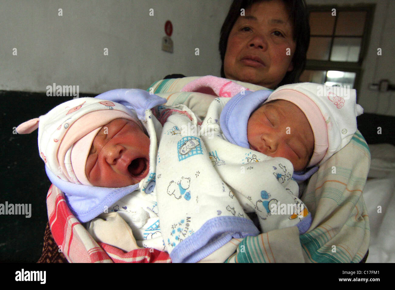 Chirurgiens pour séparer les jumeaux siamois deux jumeaux siamois sont tendrement nourris par leurs parents aimants, quelques jours avant une délicate Banque D'Images