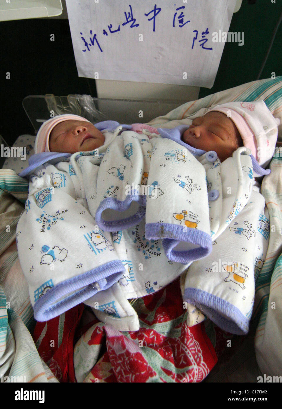Chirurgiens pour séparer les jumeaux siamois deux jumeaux siamois sont tendrement nourris par leurs parents aimants, quelques jours avant une délicate Banque D'Images