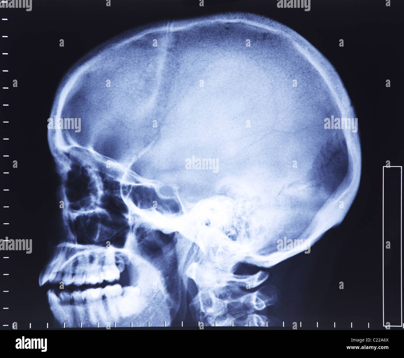 Belle image de fond du crâne rx médical Banque D'Images