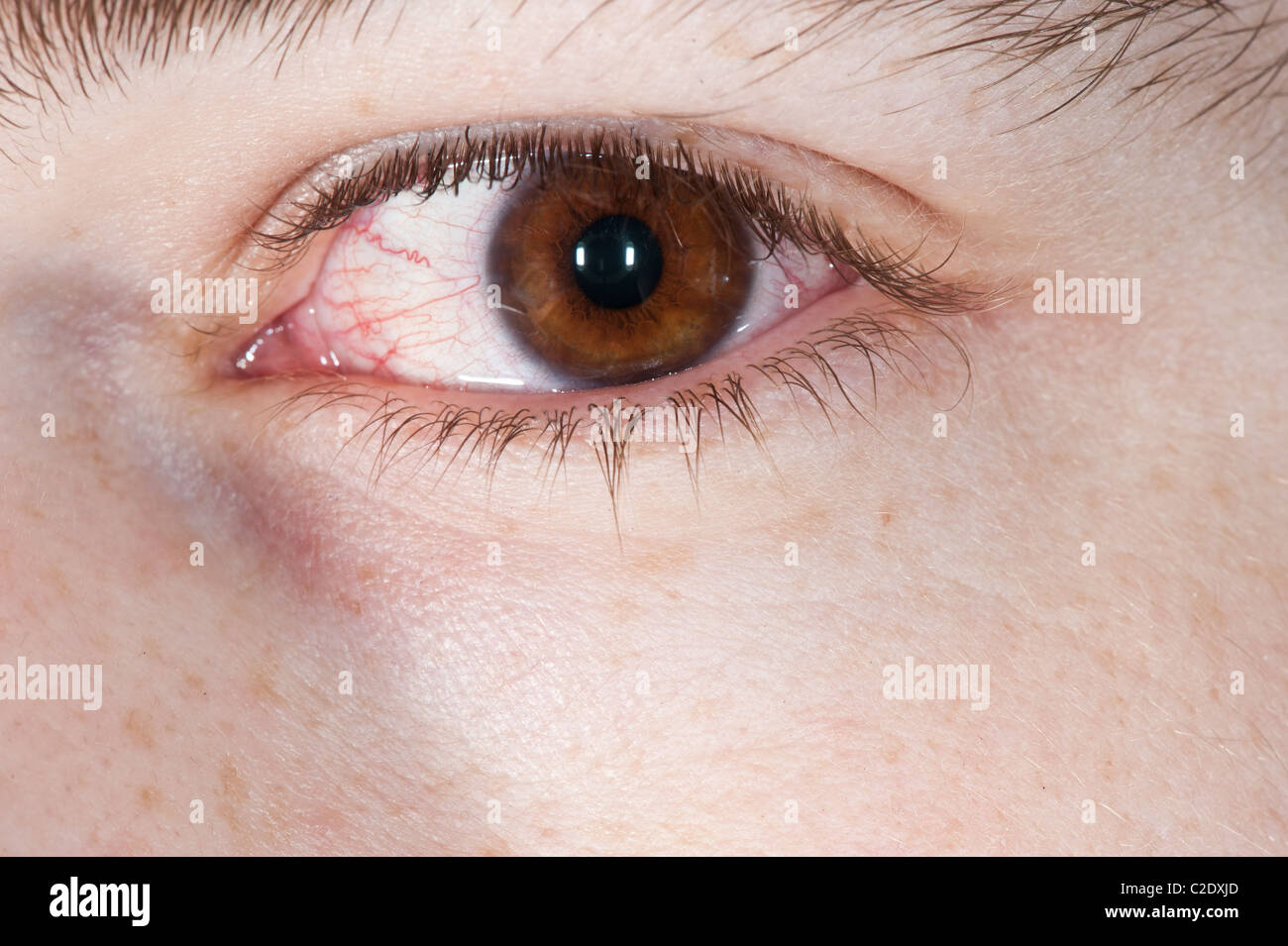 œil injecté de sang yeux Banque de photographies et d'images à haute  résolution - Alamy