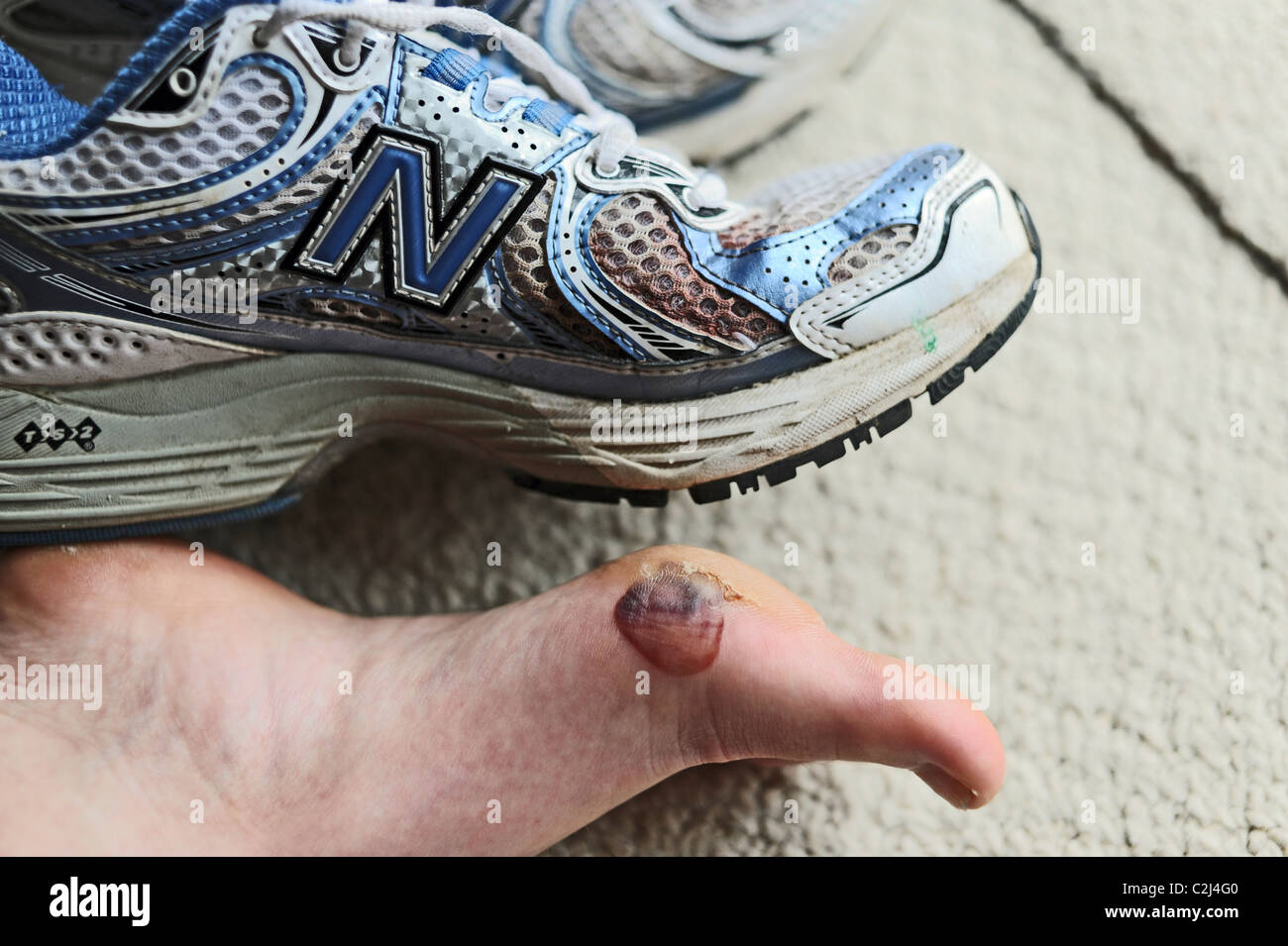 Coureuse de souffrir avec pied douloureux cloques après avoir terminé un marathon Banque D'Images