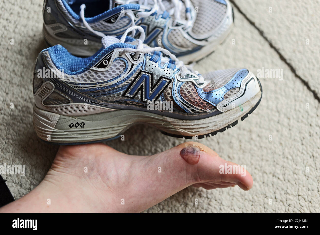 Coureuse de souffrir avec pied douloureux cloques après avoir terminé un marathon Banque D'Images