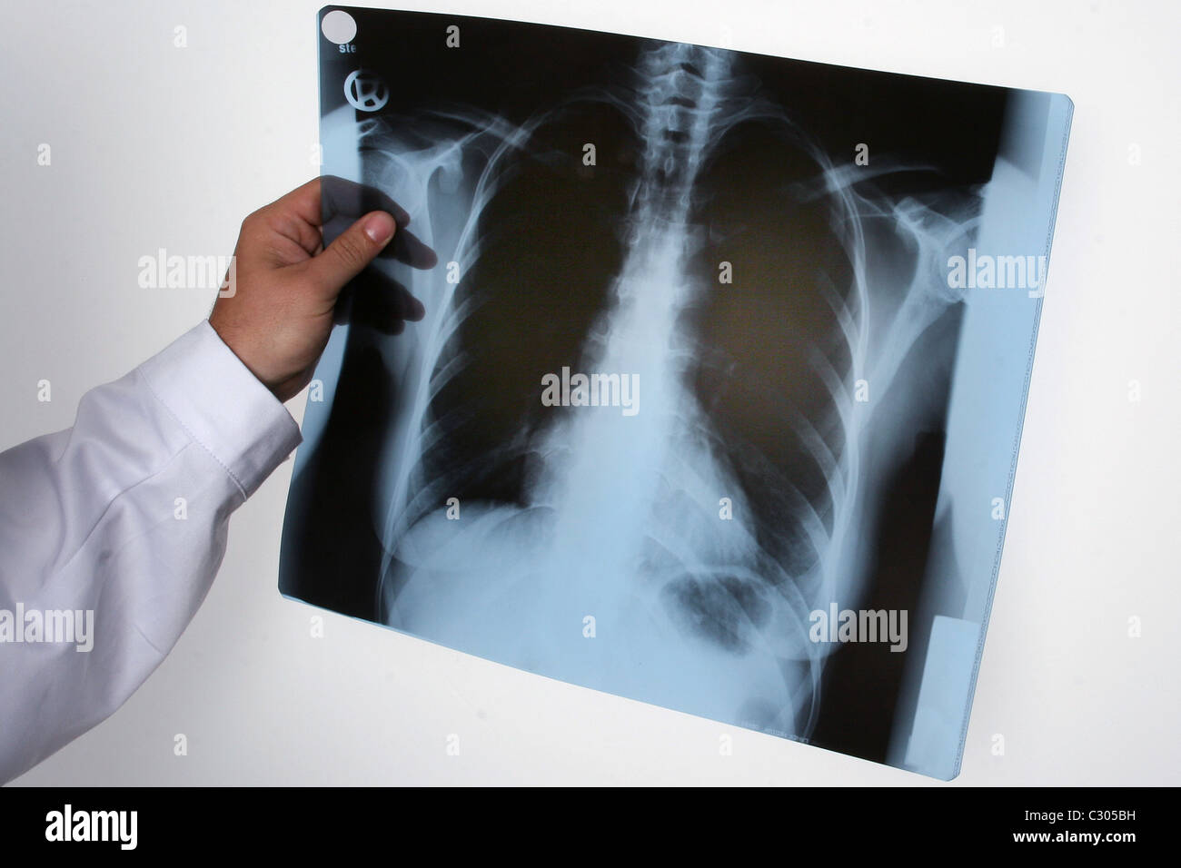 Médecin avec x-ray Banque D'Images