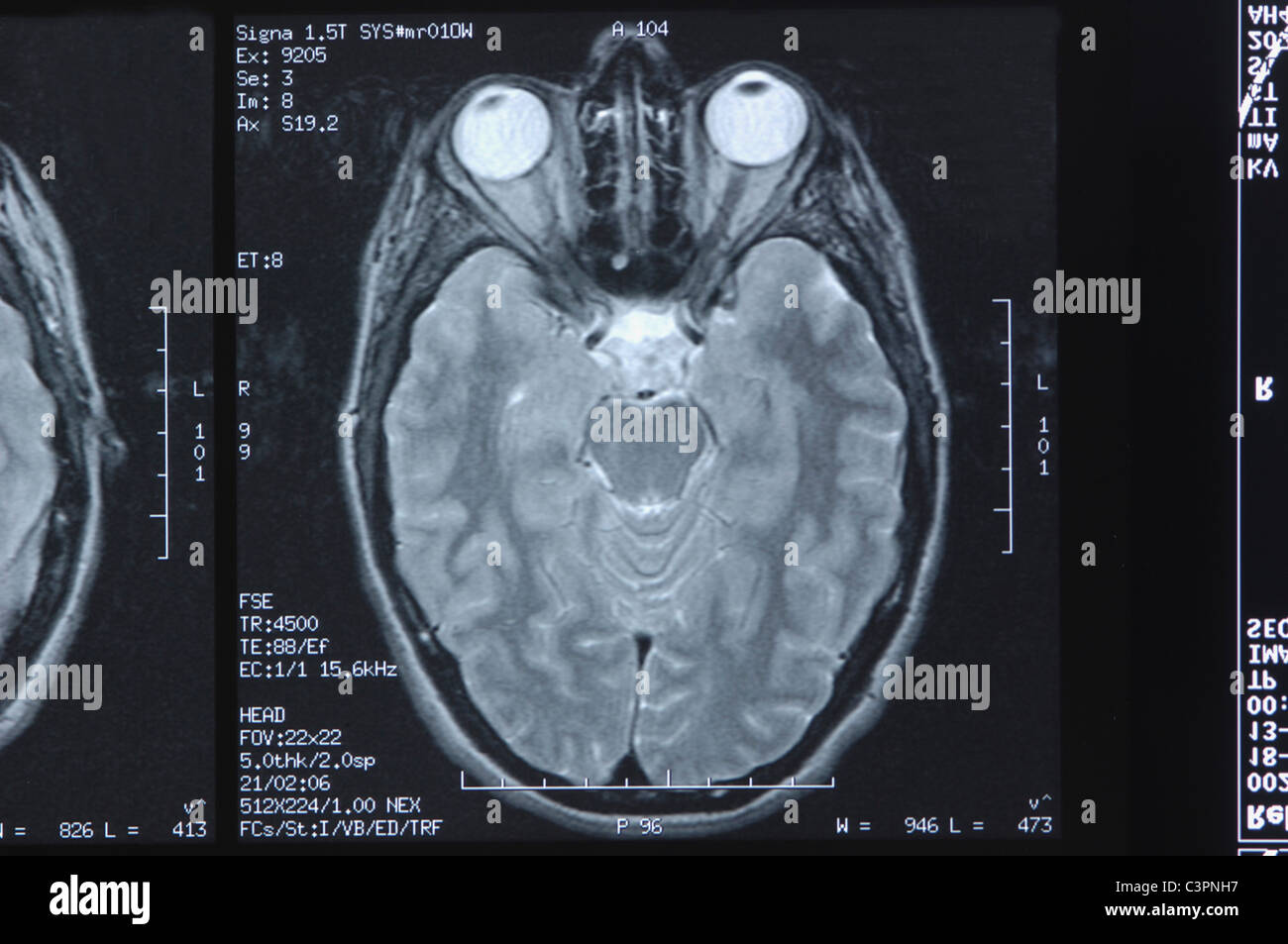 X-ray image head, Close up Banque D'Images