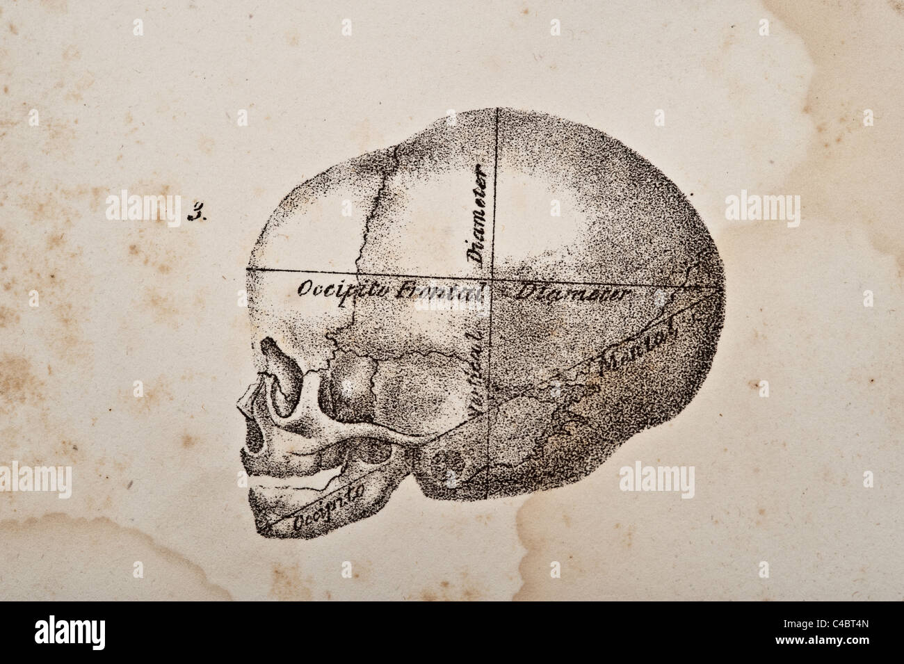 Une illustration du crâne de foetus circa 1844 Banque D'Images