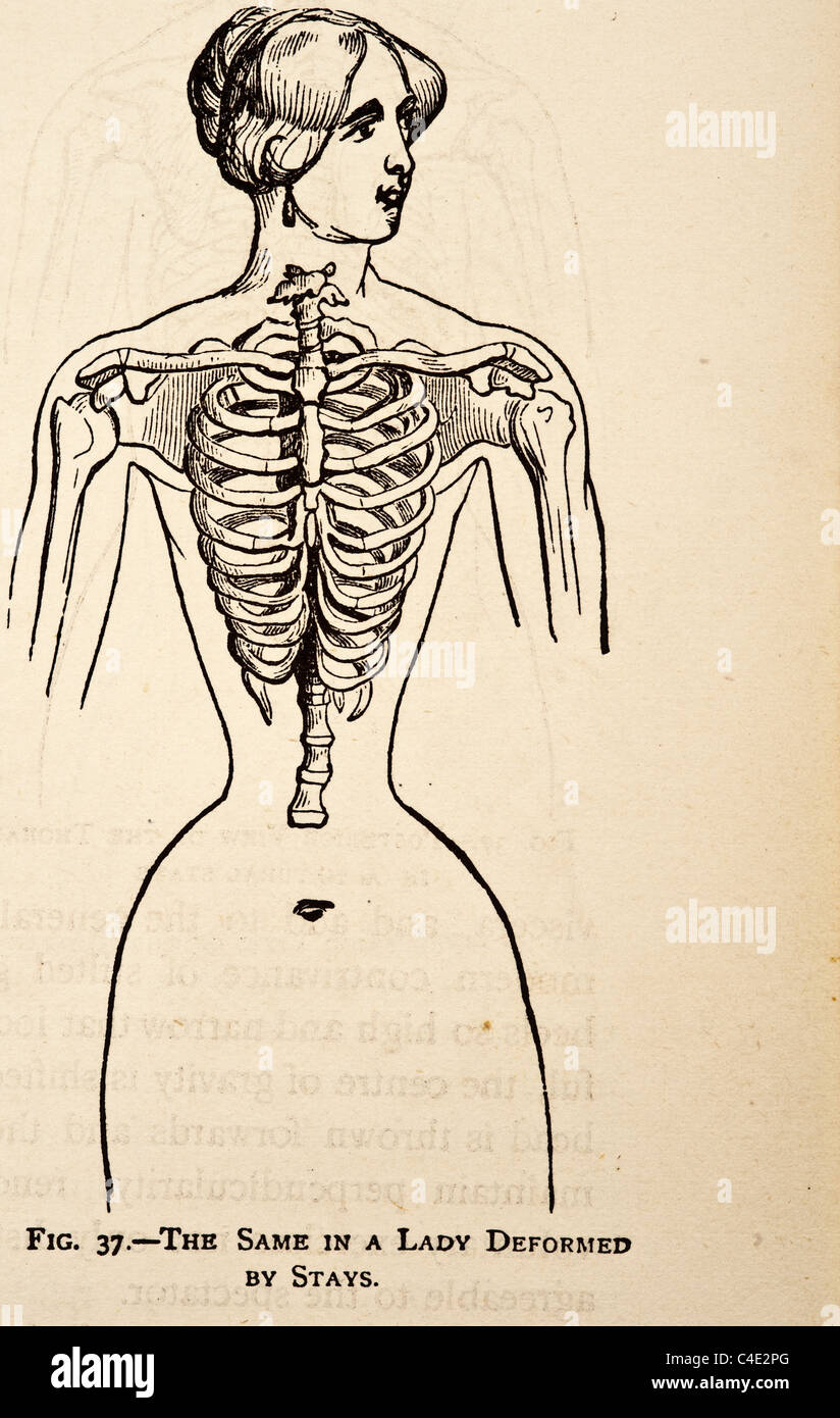 Illustration des droits de l'homme Squelette copyright 1877 Banque D'Images