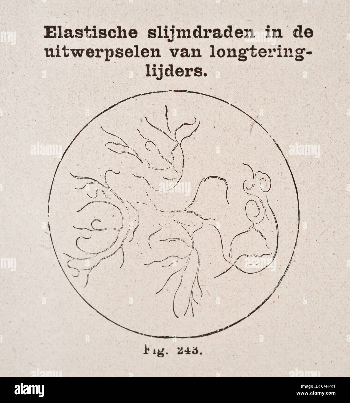Vintage Antique illustration médicale des fèces élastique de la cellule malade vers 1800 Banque D'Images