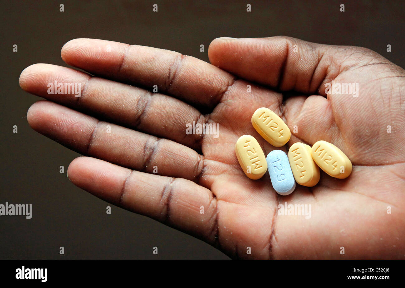 La main avec cinq tablettes haut-Antiretoviral ARV mesurée de la médecine. La ration quotidienne d'une personne malade à peine du VIH à la lutte contre le SIDA Banque D'Images