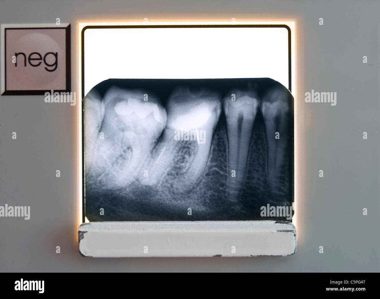 Dents roentgenogram holding Banque D'Images