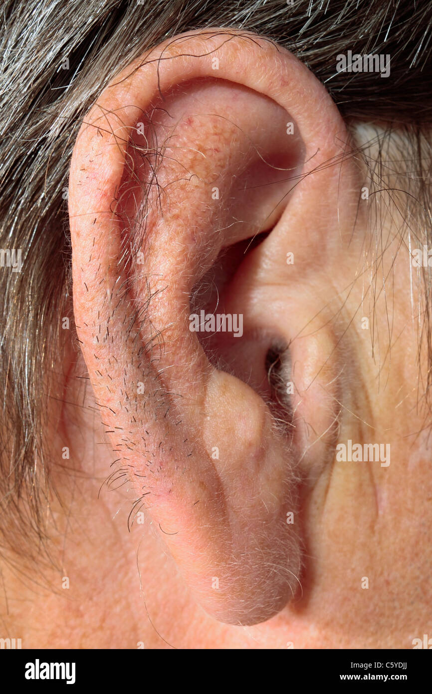 L'hypertrichose (pilosité excessive) de l'oreille jantes Photo Stock - Alamy