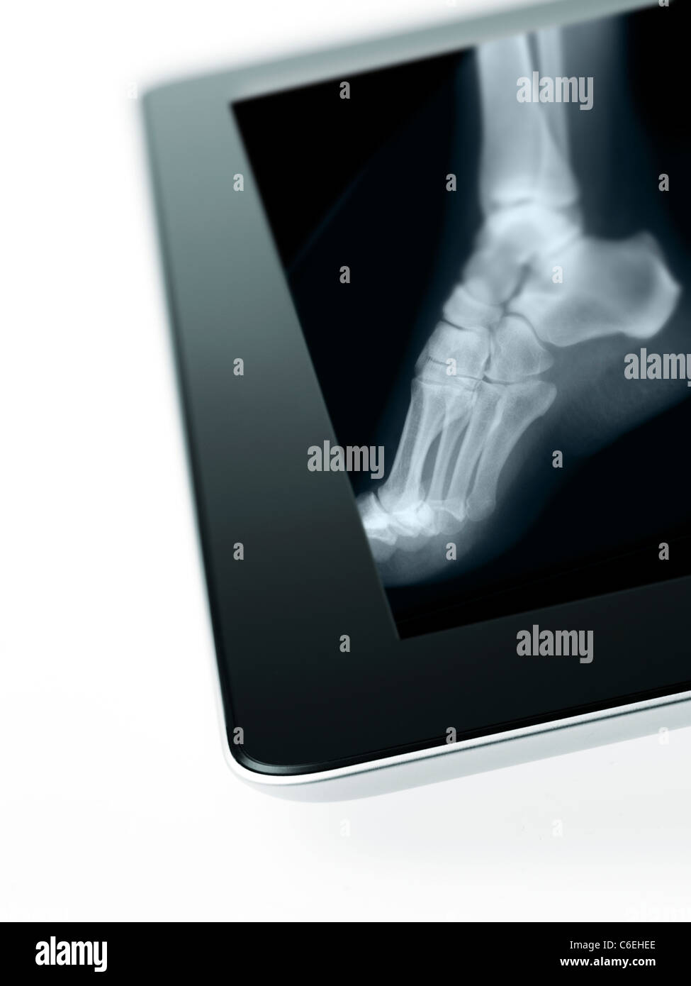Studio shot of digital tablet with x-ray de pied humain Banque D'Images