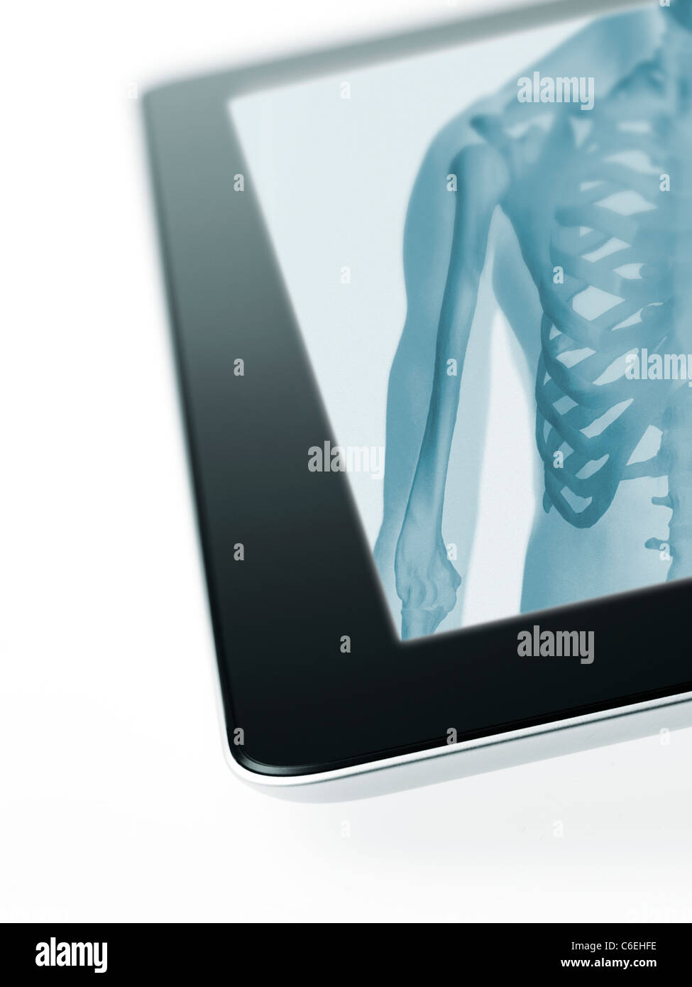 Studio shot of digital tablet with x-ray de la poitrine Banque D'Images