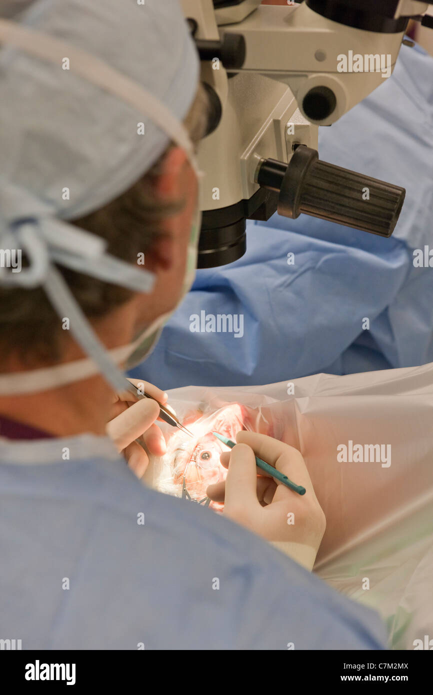 Ophtalmologiste effectuer la chirurgie de la cataracte Banque D'Images