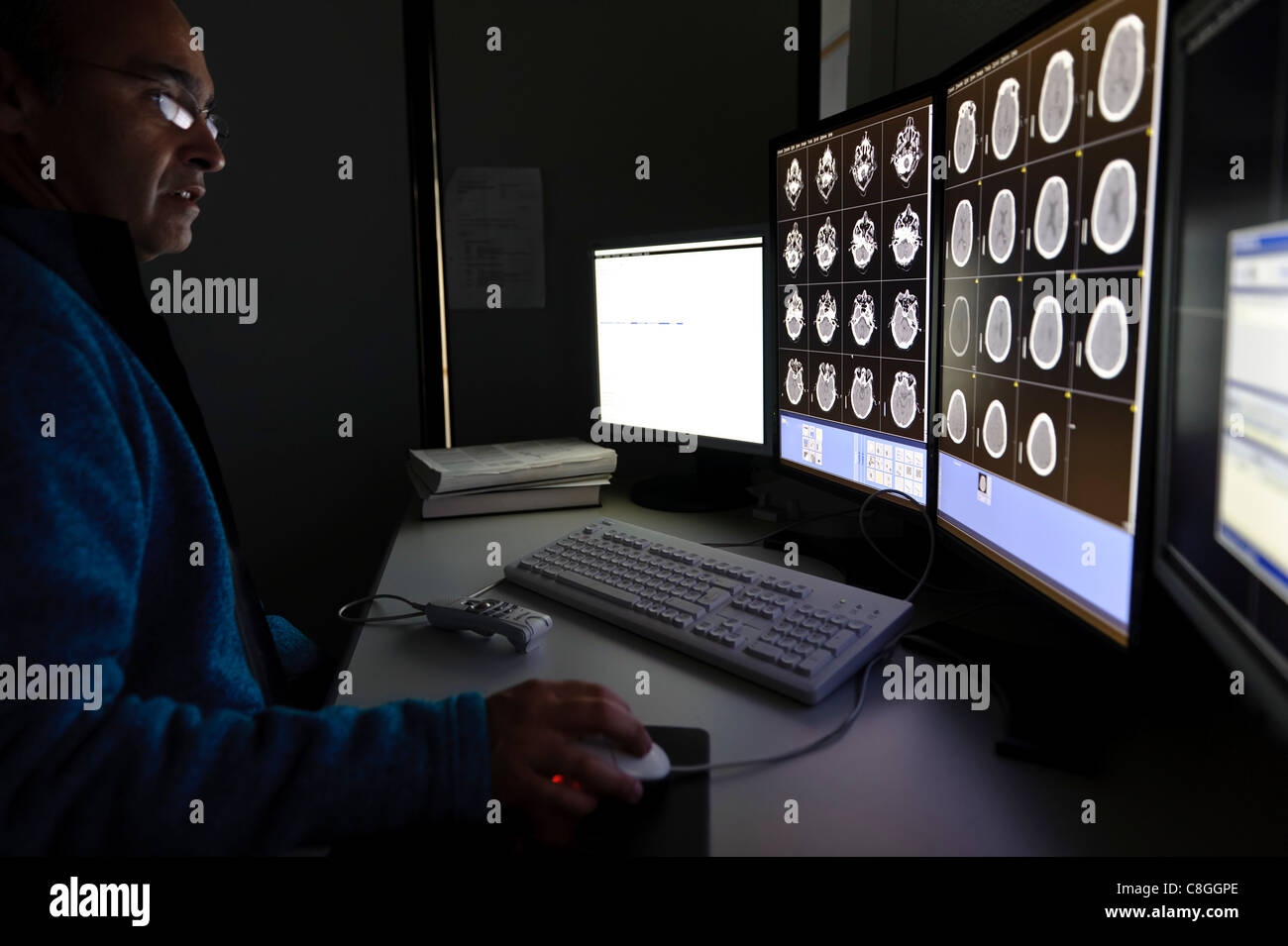 Doctor examining CT scan cérébral sur les écrans d'ordinateur Banque D'Images