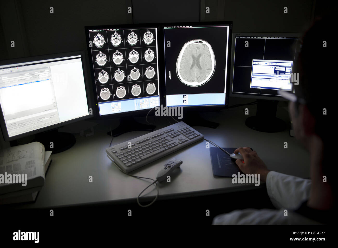 Doctor examining CT scan du cerveau à l'ordinateur Banque D'Images