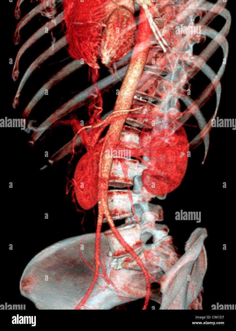 Abdomen Normal, scanner 3D Banque D'Images