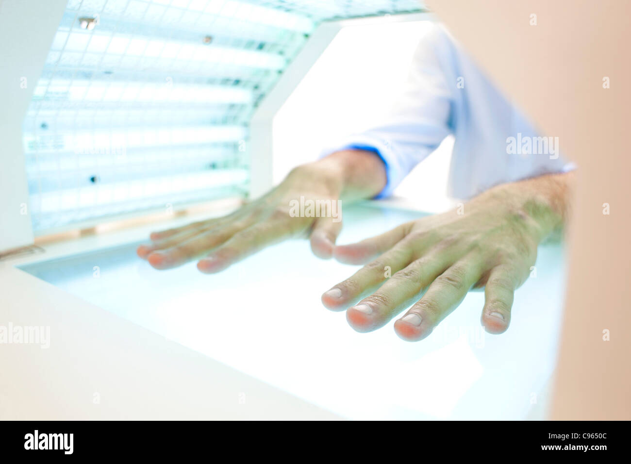 Stand de photothérapie. Patient avec leurs mains dans une boîte de la photothérapie. Banque D'Images