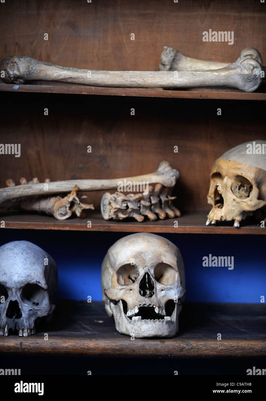 La pagaille village victorien à Newent, Gloucestershire - un musée d'objets victoriens - crânes et d'os dans la chirurgie du médecin Banque D'Images