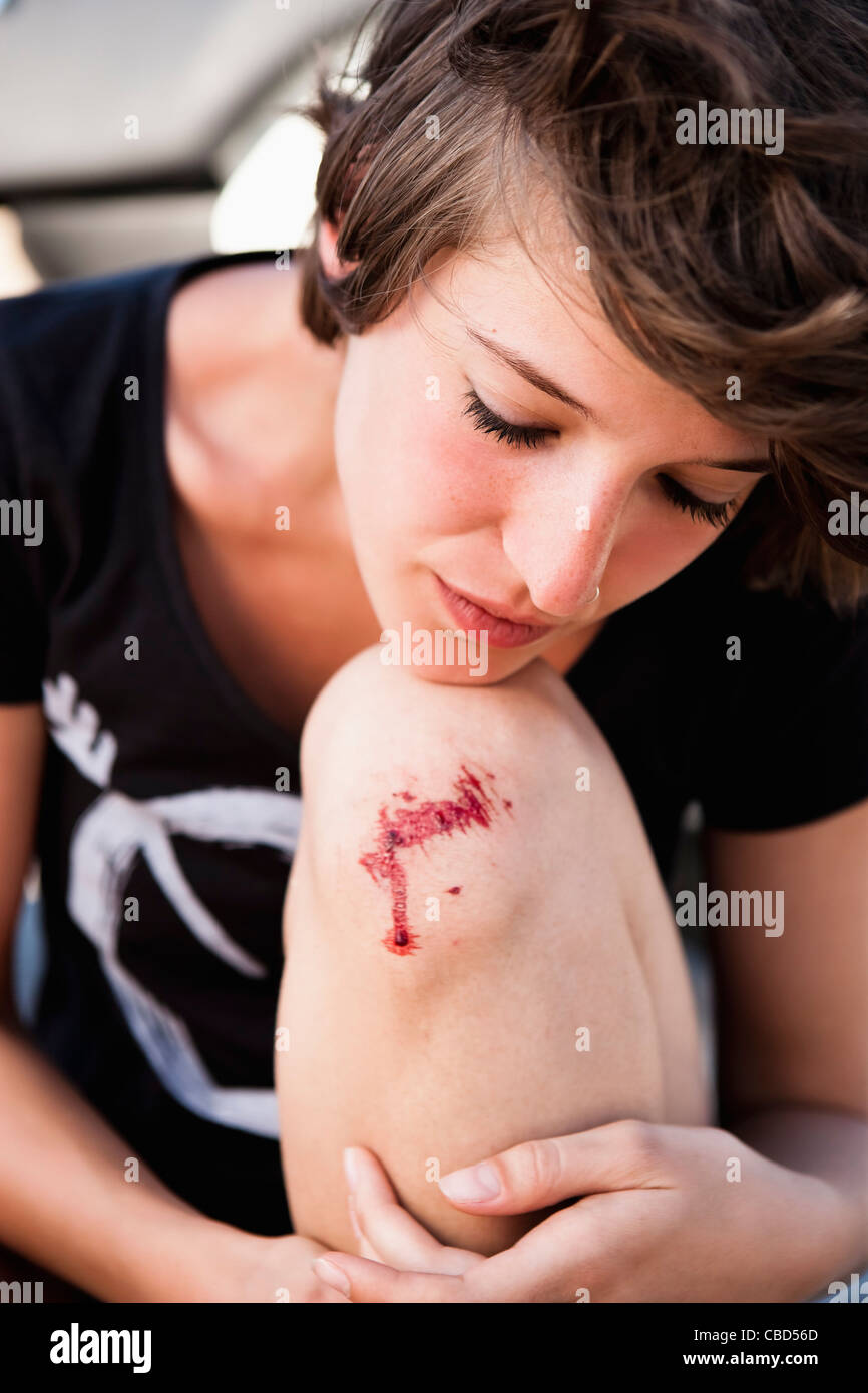 Woman examining knee grattées Banque D'Images