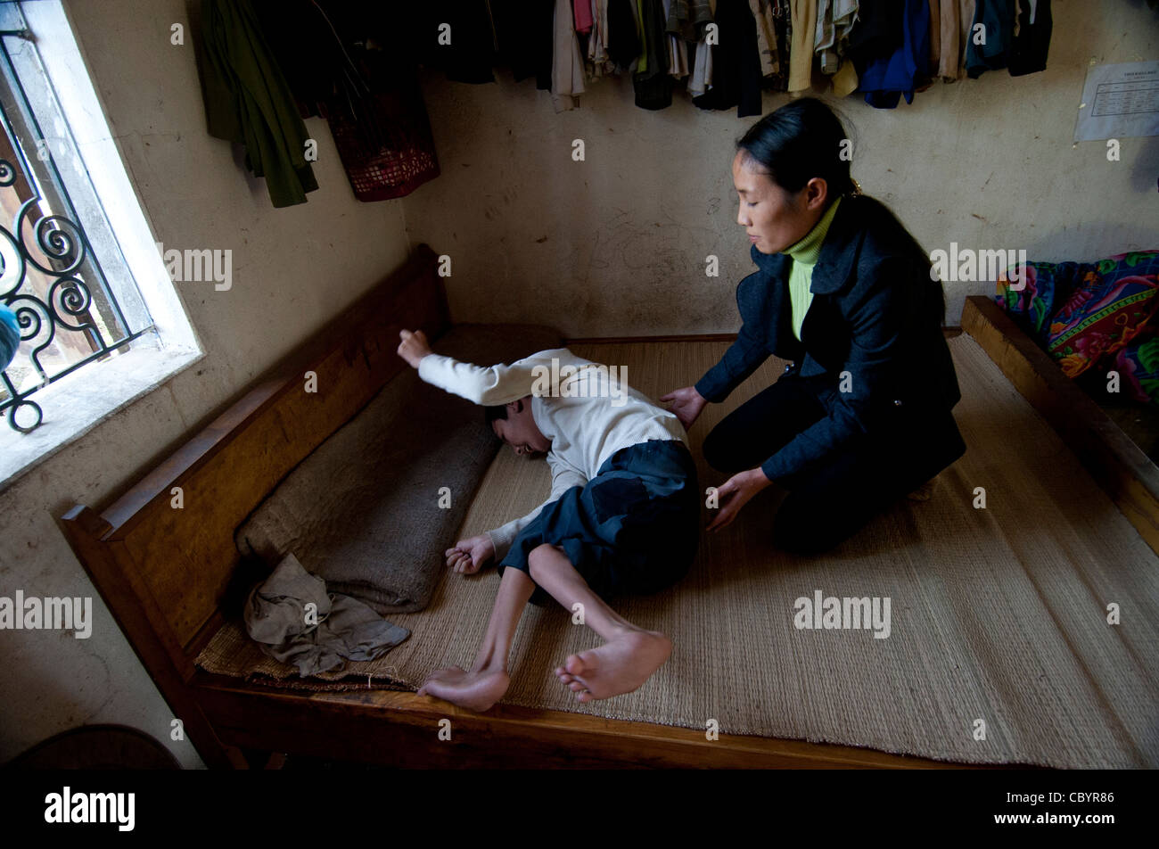 Les trains physiothérapeute parent à prendre soin d'enfant handicapé dans la réhabilitation à base communautaire pour le Vietnam. Banque D'Images